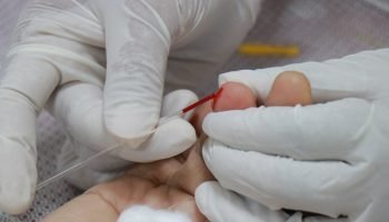 diabetes-capa